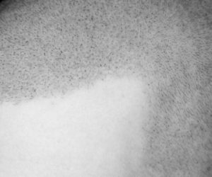 derma_pigment2 derma_pigment2